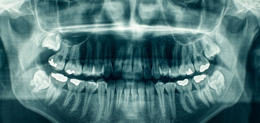 Radiologia Odontológica